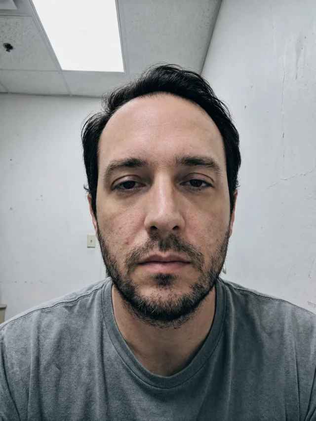 Close-up portrait of a man with skin tone evened out, shine and under-eye shadows reduced, while his facial features and natural skin texture stay unchanged
